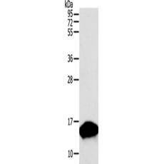 兔抗PVALB多克隆抗體 